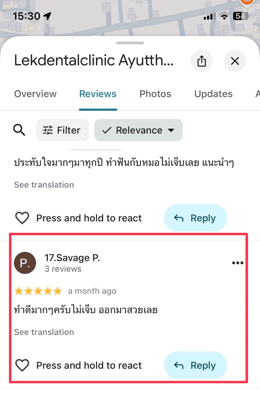 รีวิวคนไข้ทันตกรรมครอบฟันเซรามิกหน้าวันเดียวเสร็จน้องวุฒิ