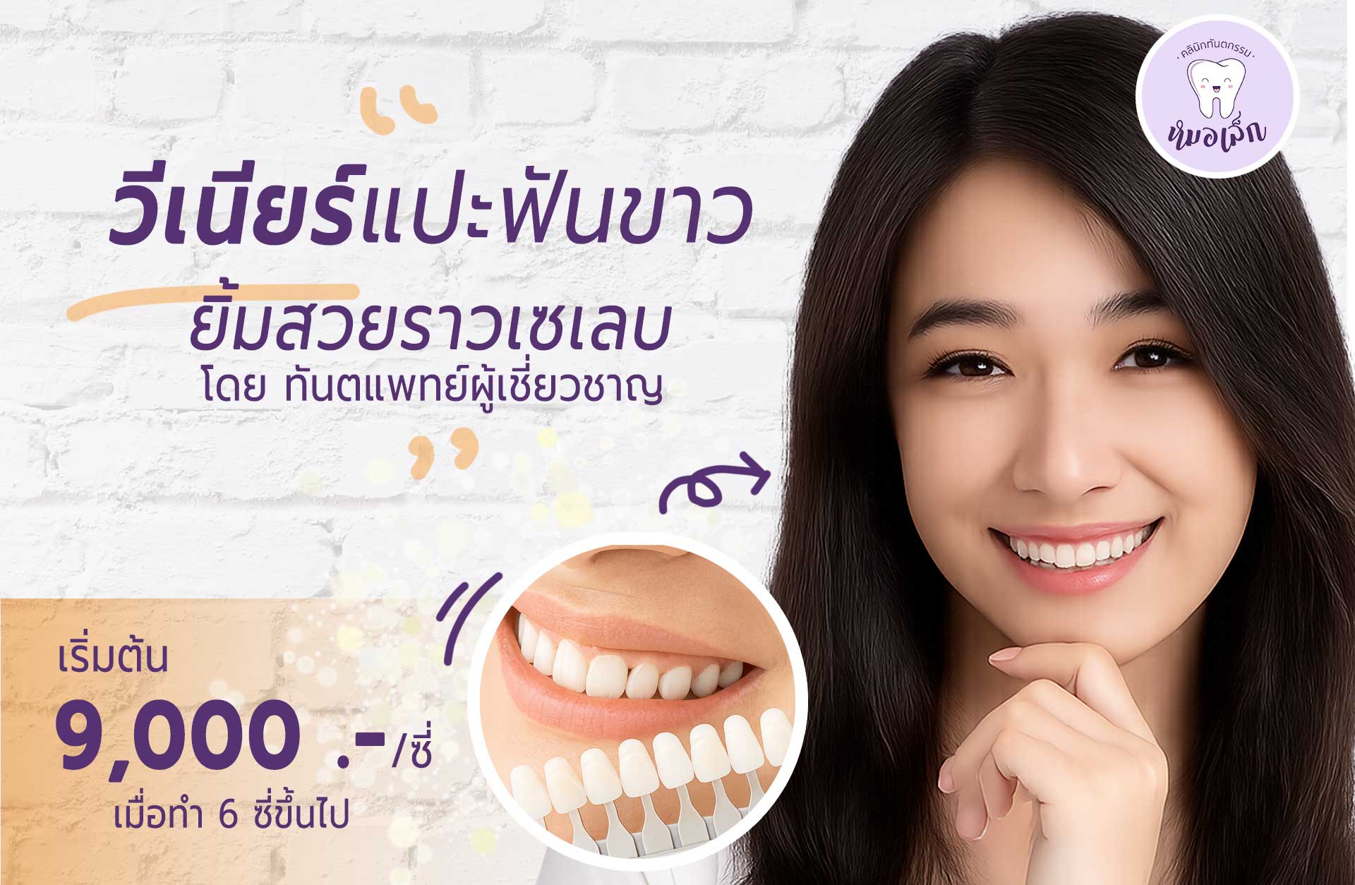 วีเนียร์แปะฟันขาว ยิ้มสวยราวเซเลบ