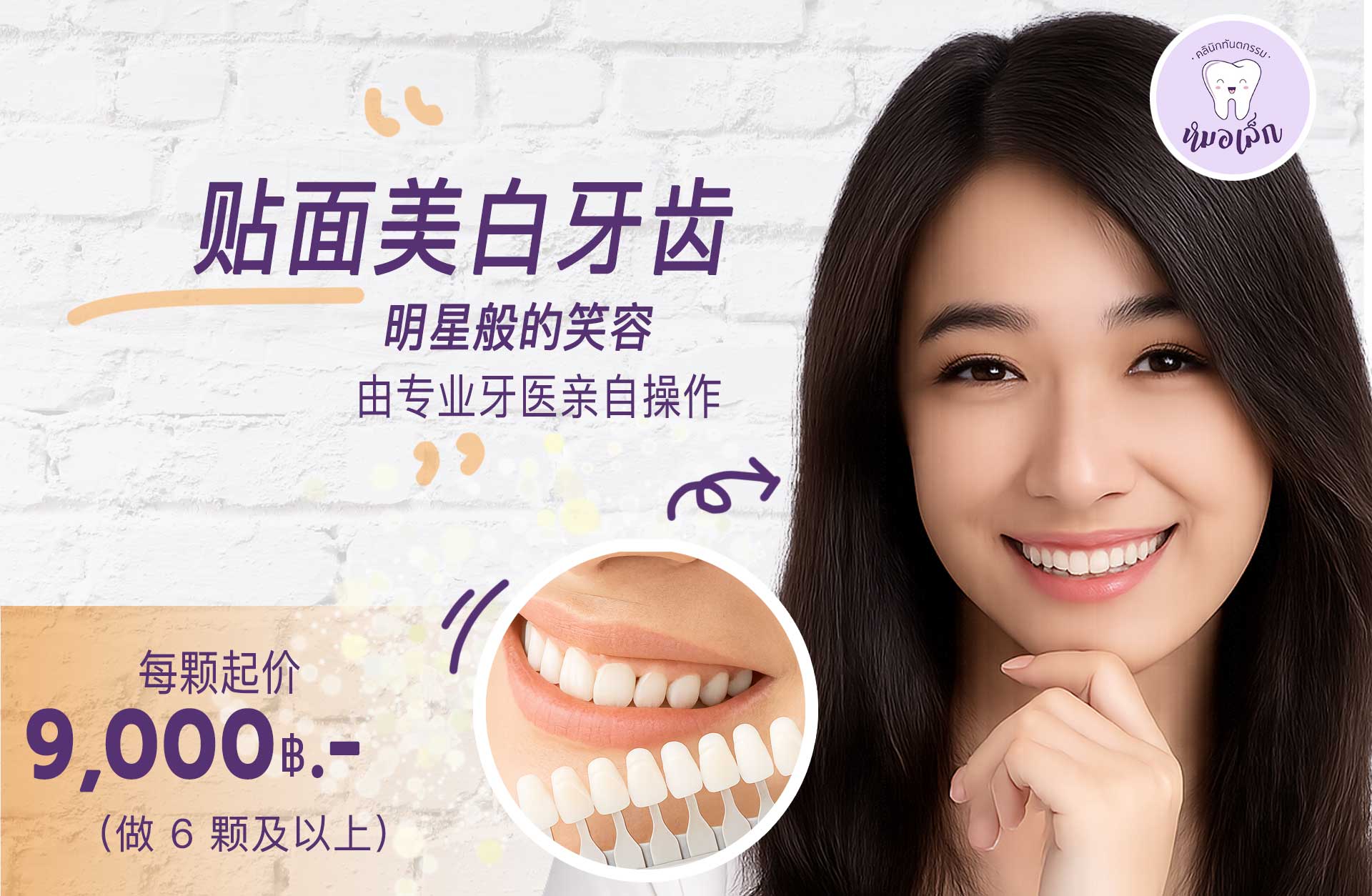 贴面美白牙齿 明星般的笑容